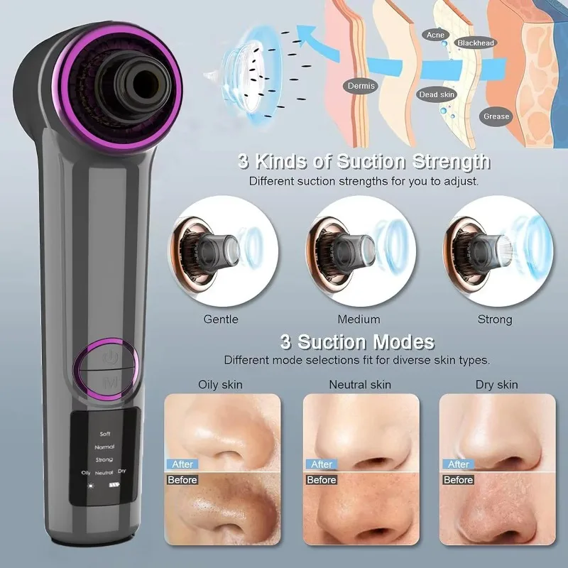 

Electric Face Pore Cleaner Acne Removal Machine Facial Heating Micro Bubble Stainless Steel Vacuum Blackhead Remover