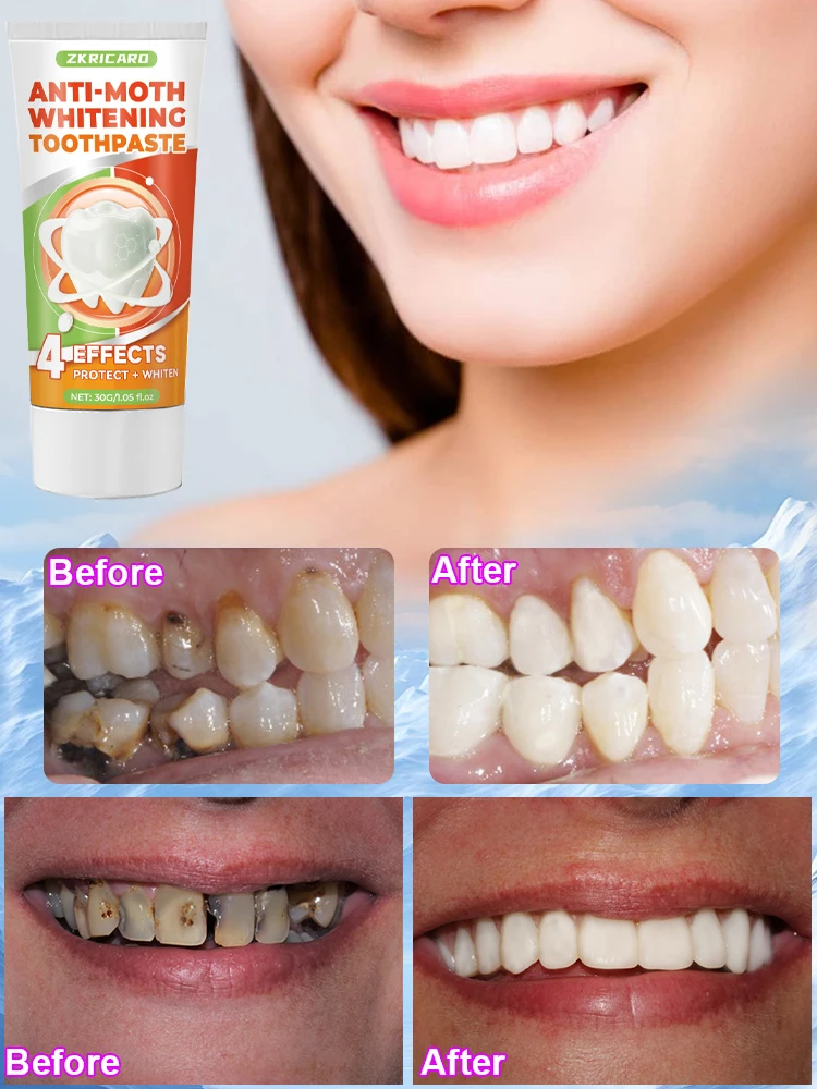 Hot selling scientific fluoride repair tooth decay removal