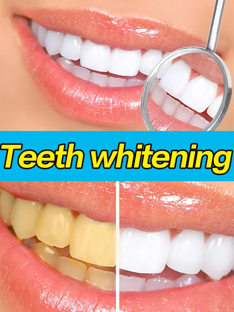 Deep Cleaning Quick Of Teeth To Stains