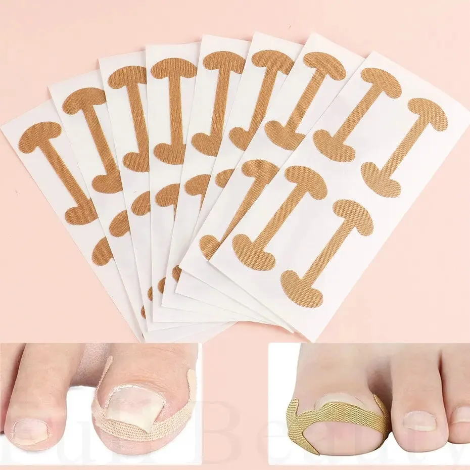 Iningrown toenail補正ステッカー、接着剤ネイルパッチ、弾性ネイルトリートメント、フットケアツール