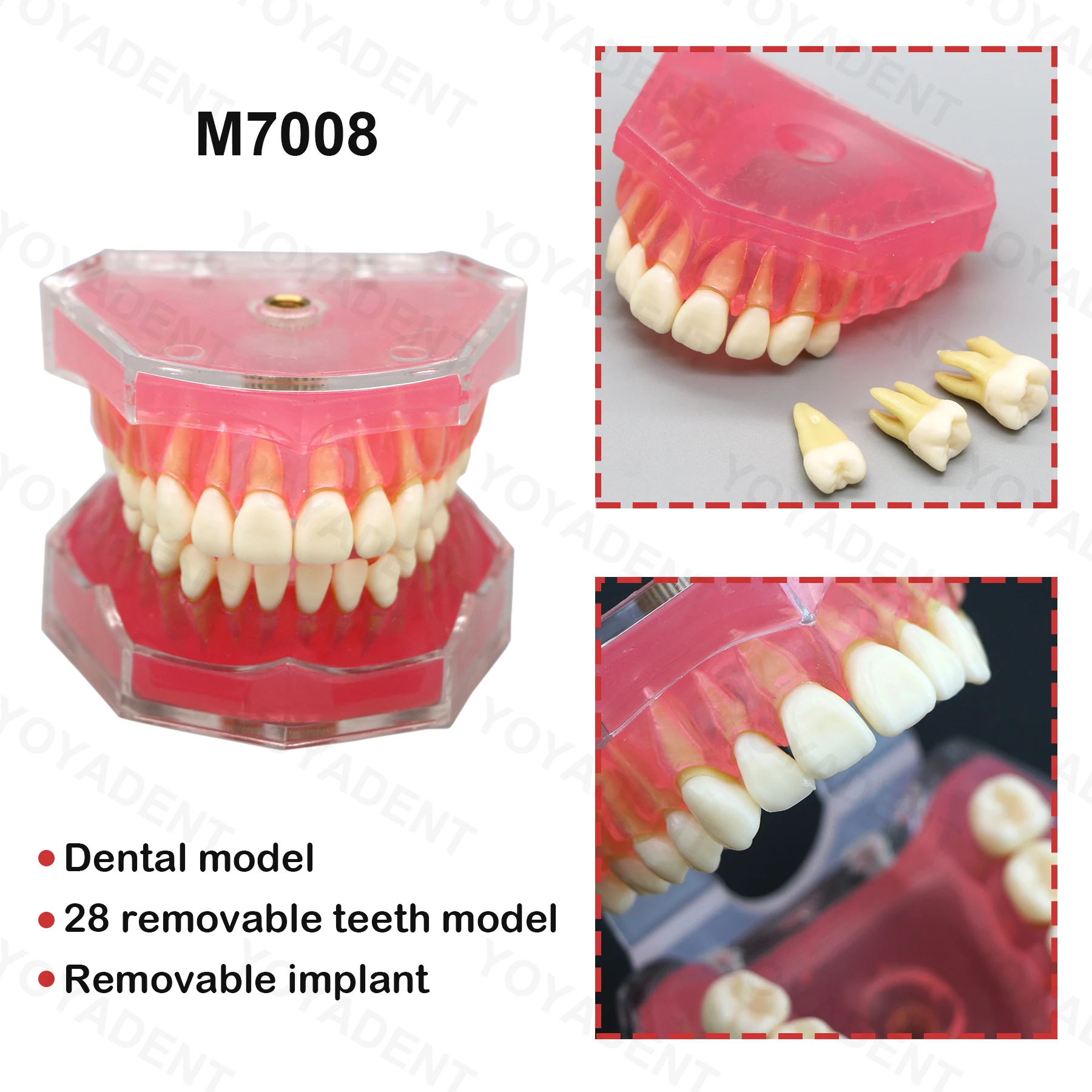 Dental Teaching Model Removable Tooth Model Simulated Cheek Doctor-Patient Communication Model Soft Gums Are Removable