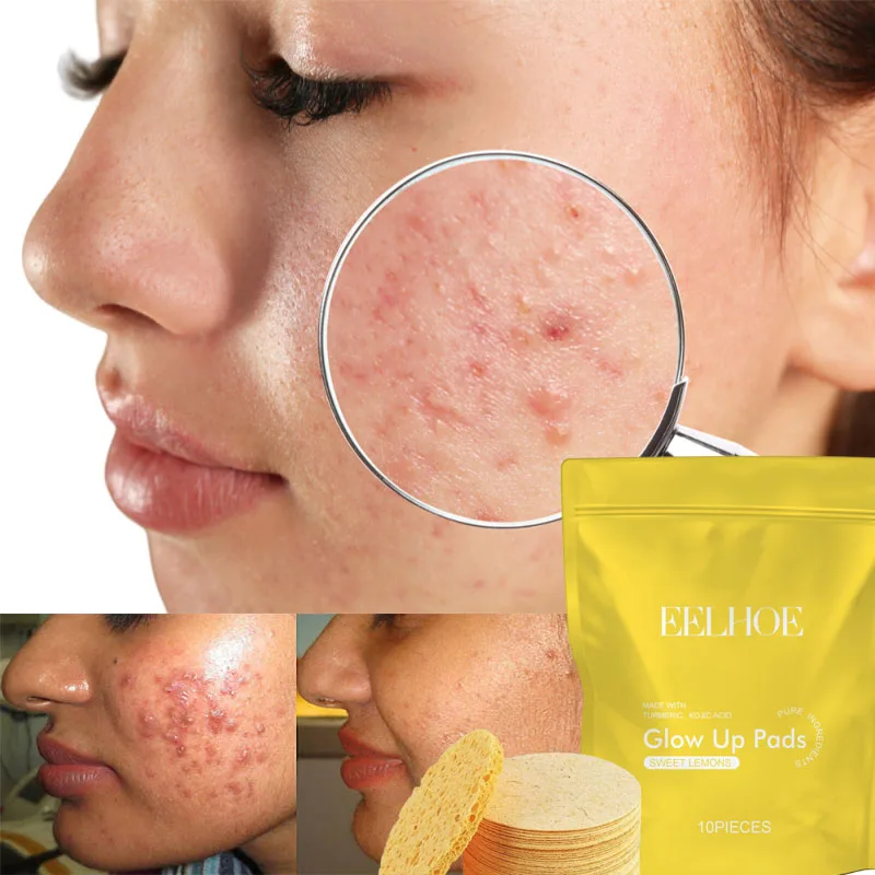 

Turmeric Kojic Acid Cleansing Pads Exfoliating Pads Facial Sponges Removes Dirt Cleansing Exfoliating Daily Cleansing Skin Care