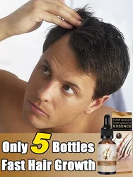 Biotin Fast Hair Growth Hair Regrowth Serum Hair Thinning Growth for Women and Men