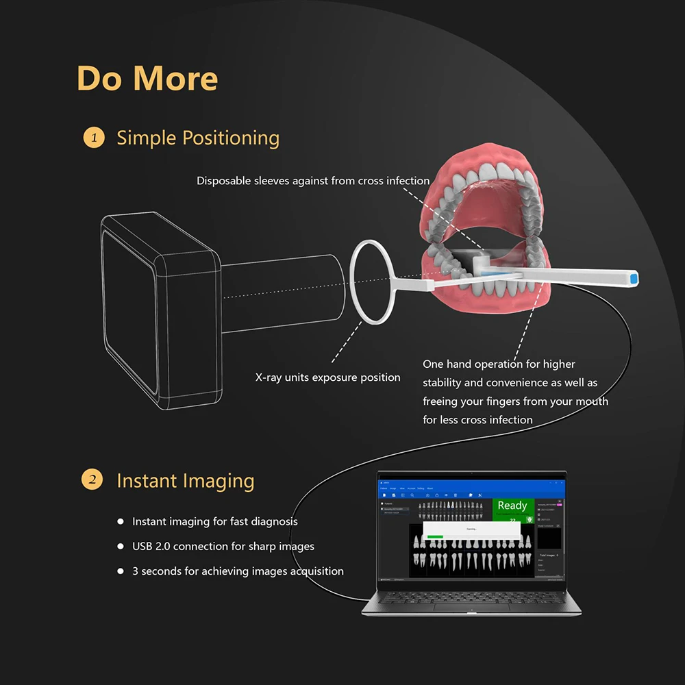 Escáner de placa de imagen de sensores digitales dentales, Sensor de rayos X, sistema de máquina de imagen, Unidad de rayos X de alta frecuencia