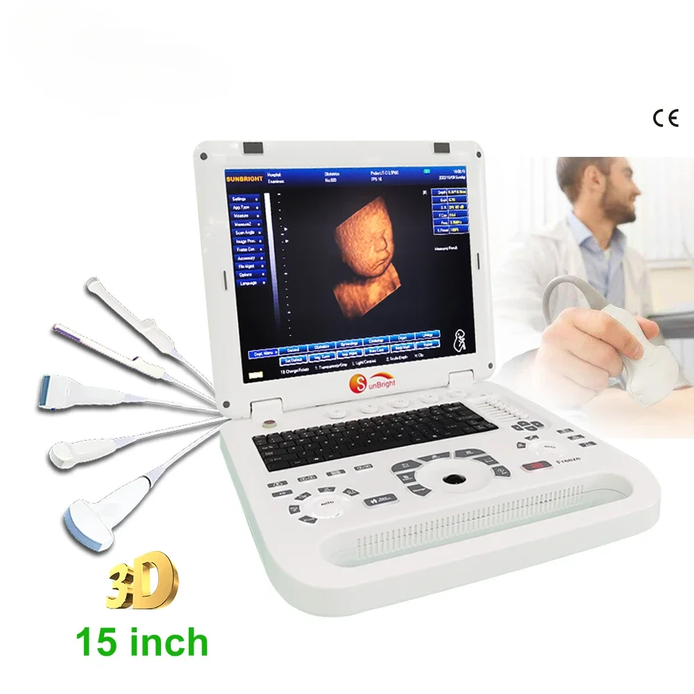 laptop echo 15 inch medical image diagnosis use portable 3D ultrasound machines