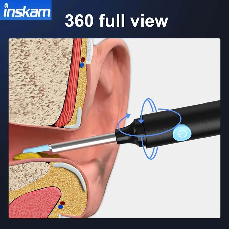 أداة إزالة الشمع بمنظار الأذن البصري الذكي، أداة إزالة الشمع، كاميرا صغيرة للعناية الصحية بالأذن #2