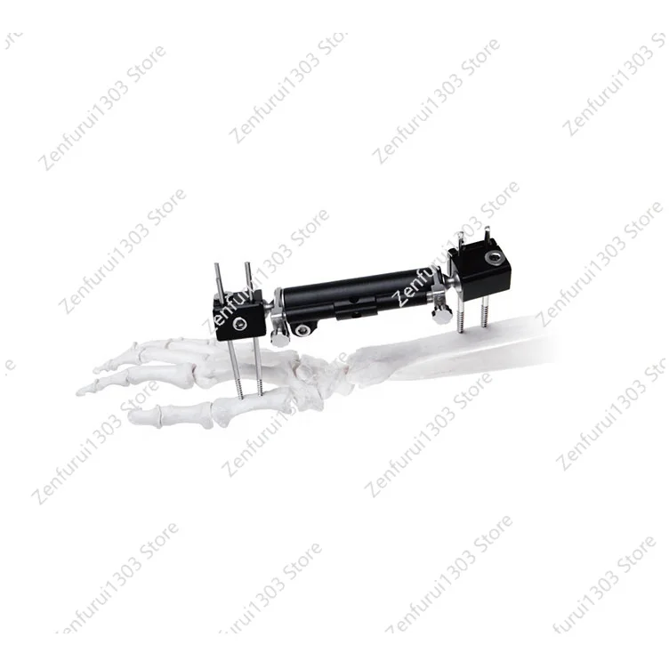 Manufacturer Price Orthopedic External Fixation Radiopaque Wrist Fixator External Fixator