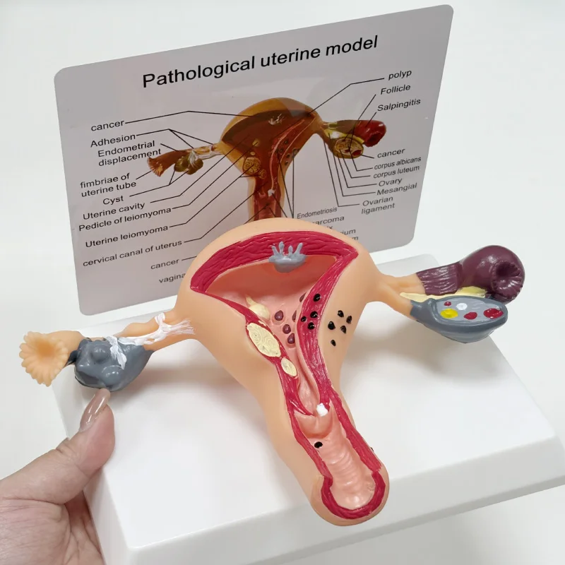 

Anatomical Pathological Uterus Ovary Model Cross Section Study Tool