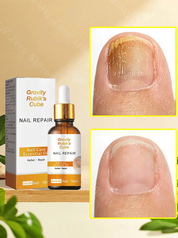 

Nail Fungus Treatment