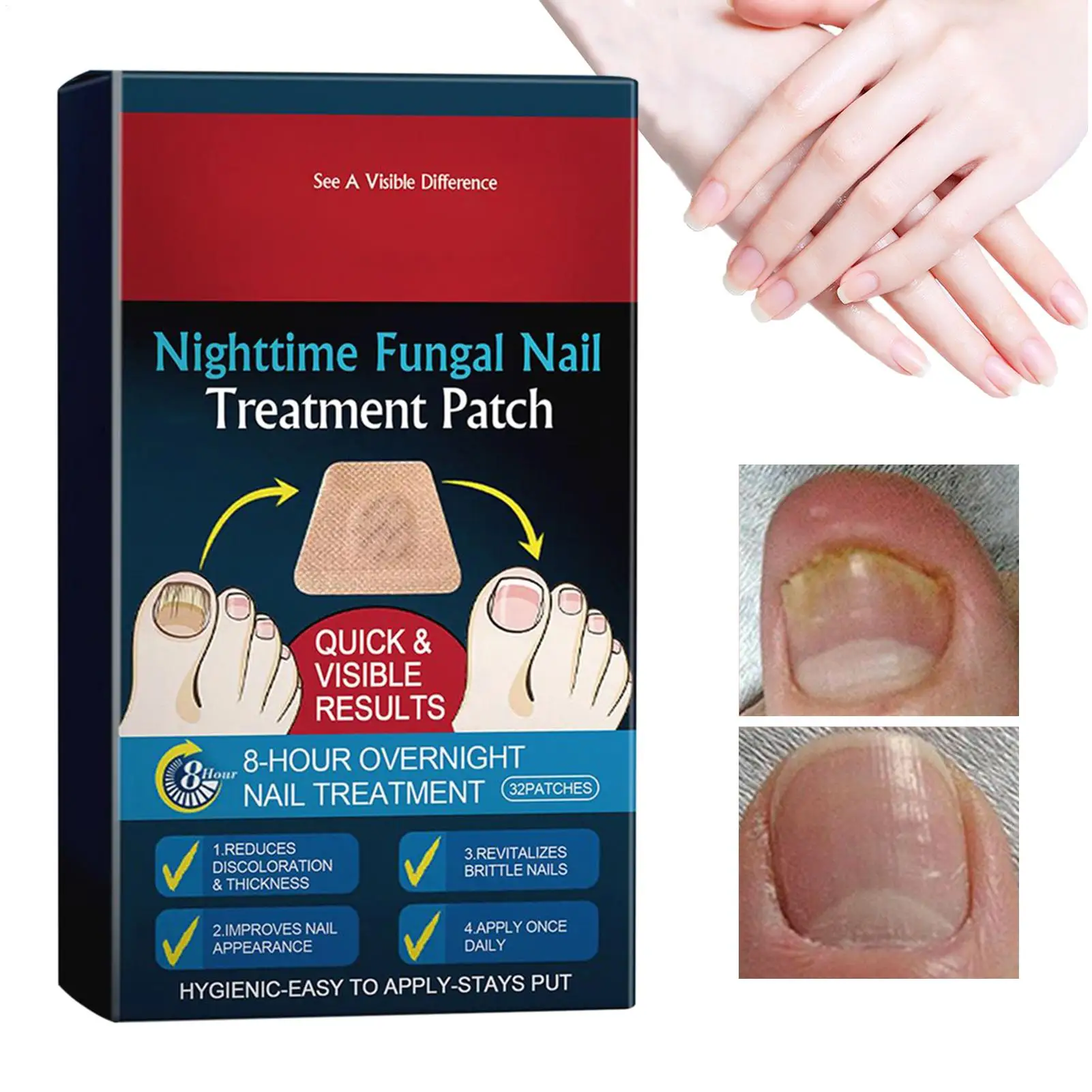 ホット 32 個ネイル修復パッチ足爪再生補正ステッカー爪周囲炎回復ペディキュアツール割れた爪保護テープ