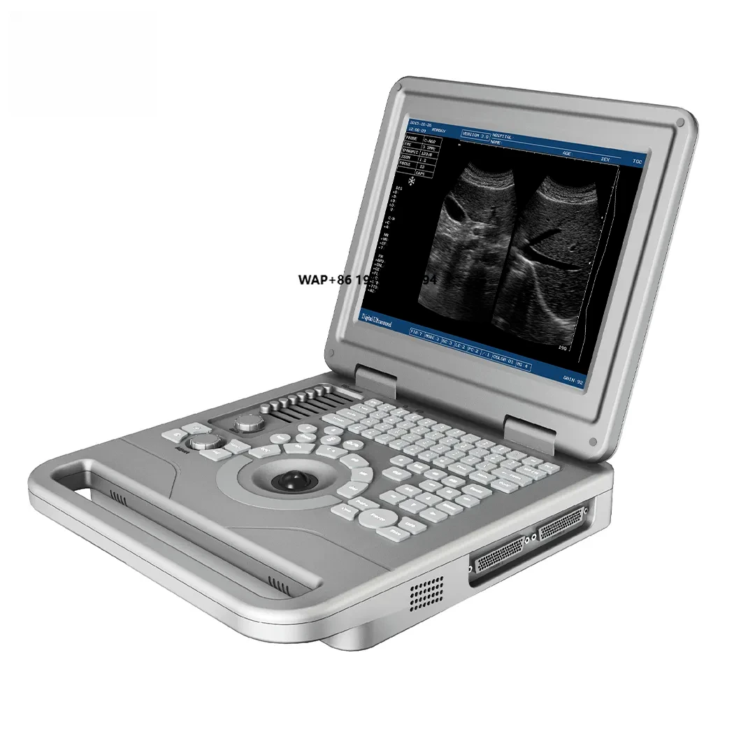 S70A Veterinary Portable Digital Ultrasound System 12.1-inch LCD 3-hour battery life, pet  detection, metal material