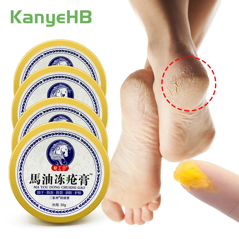 1-2-4pcs Horse Oil Foot Heel Cracked Cream Treatment Hand Frostbite Crack Moisturizing Relieve Skin Drynes Foot Mask Health Care