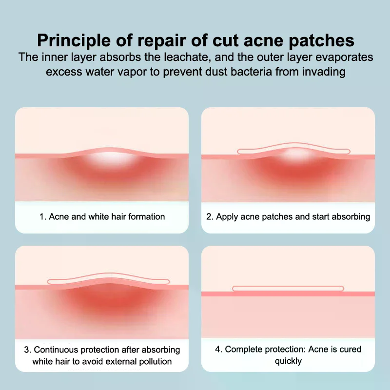 Waterproof Extra Thin Soft Disposable Bordered Hydrocolloid Dressing Wound Band Aid Medical Hydrocolloid Dressing