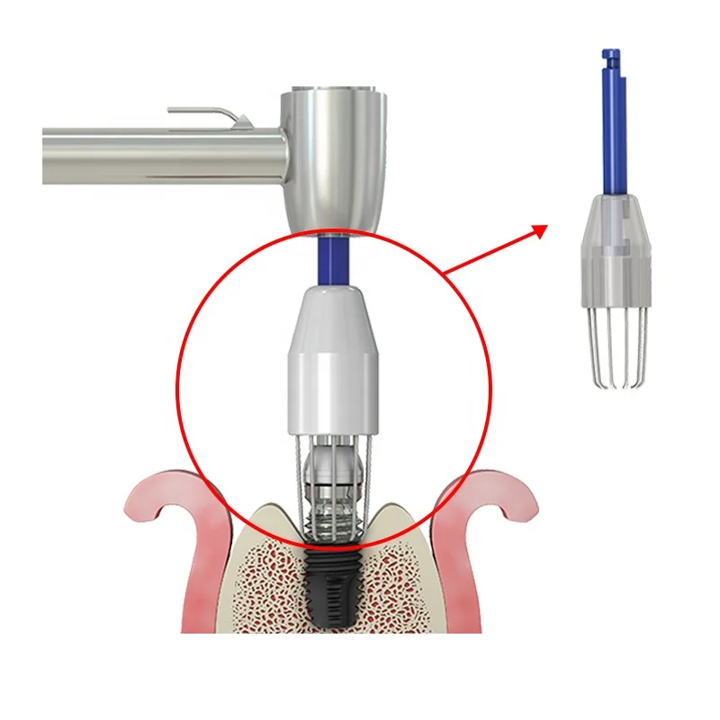 Original Neobiotech R-Brush Dental Surface Decontamination Titanium Brush Tooth Cleaning Dental Surgical Tools