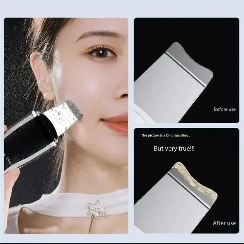 Ultrasone peelingmachine Acne huishoudelijk elektrisch mee-eterinstrument Poriënreiniger mee-eter verwijderingsgereedschap reinigingsinstrument