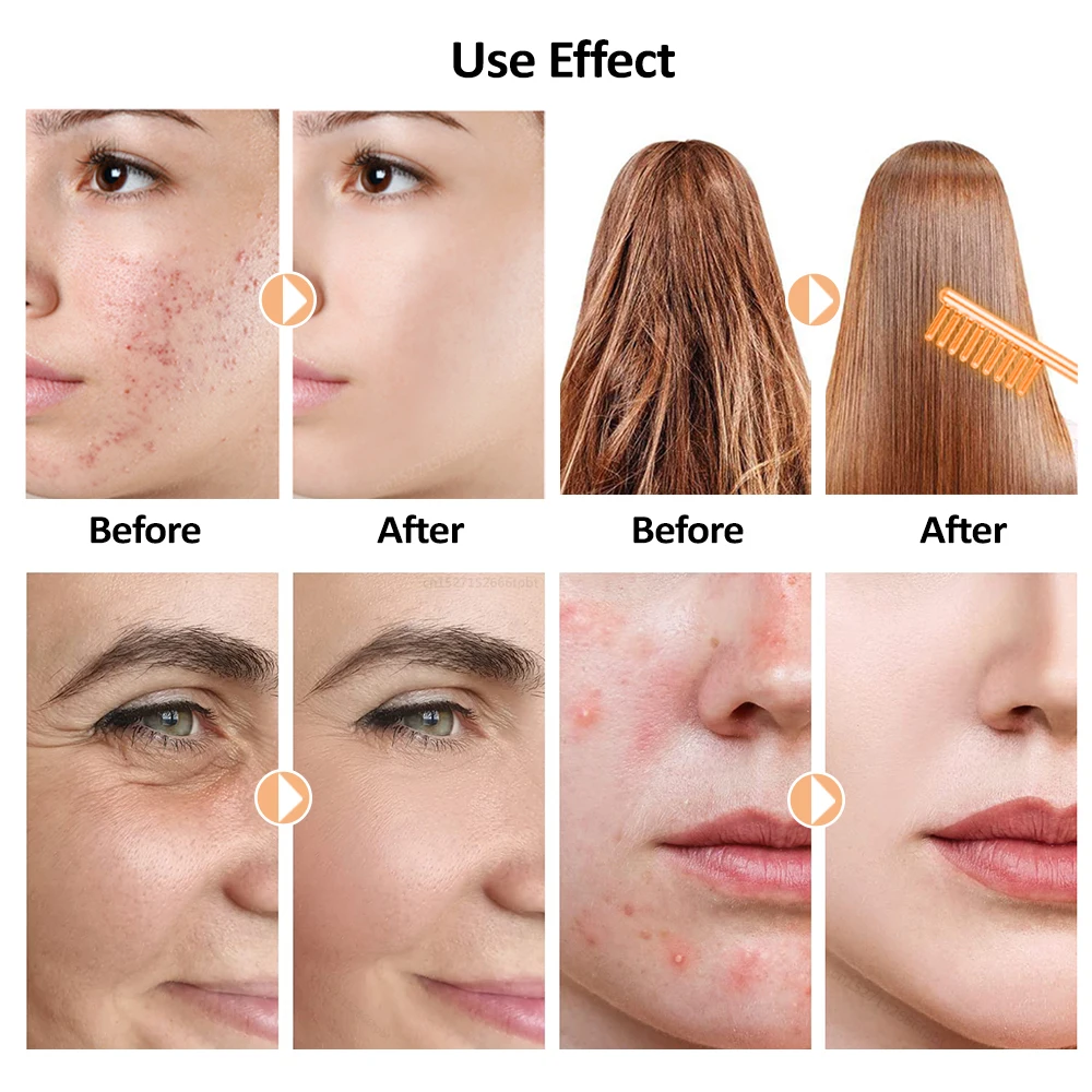 المحمولة عالية التردد آلة الوجه العلاج الكهربائي العصا القطب الزجاجي أنبوب الجلد التجاعيد جهاز الوجه أدوات العناية بالبشرة