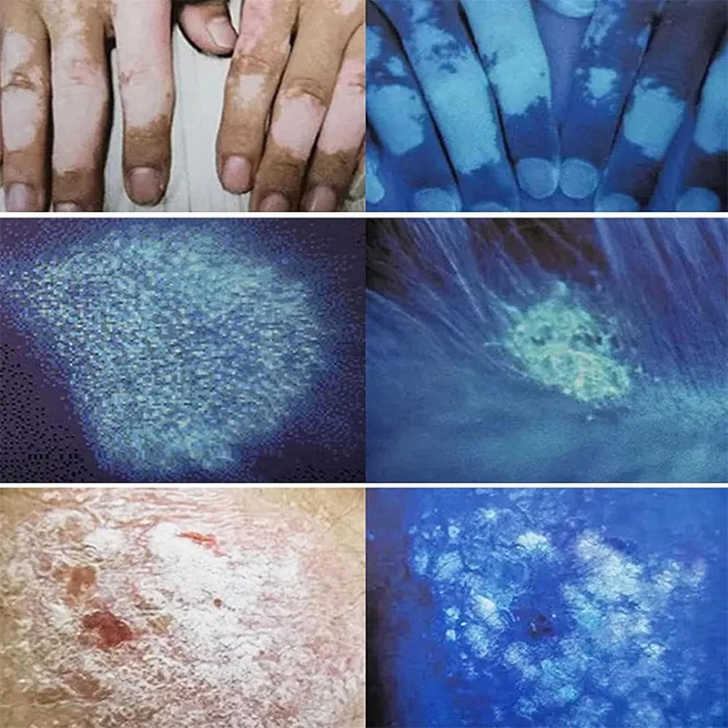 Lamp Skin Analyzer Portable Facial Salon Beauty Analyzer UV Handheld Lamp for Pet Cat and Dog Skin Detection Skin care