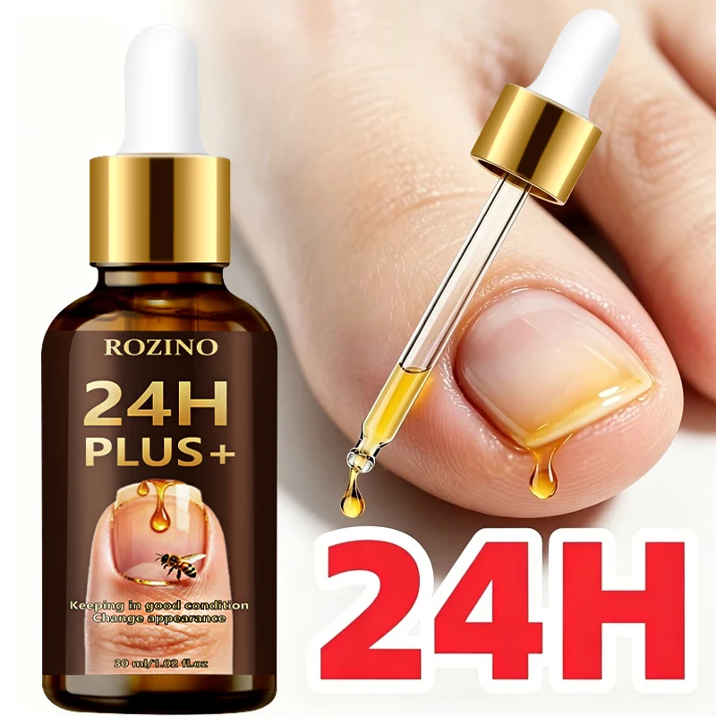 1Pcs/2Pcs/3Pcs 24H Nail Care Oil, 5-Minute Nail Renewal, Maximum Strength -98% Change in Appearance, Maintains Good Condition, Quick/Hardening, Enhances Nail Shine, Suitable for Thickened and Damaged Nails, Prevents Discoloration and Thickening of Nails, Promotes Nail Health, Prevents Fingernails and Toenails from Peeling and Breaking
