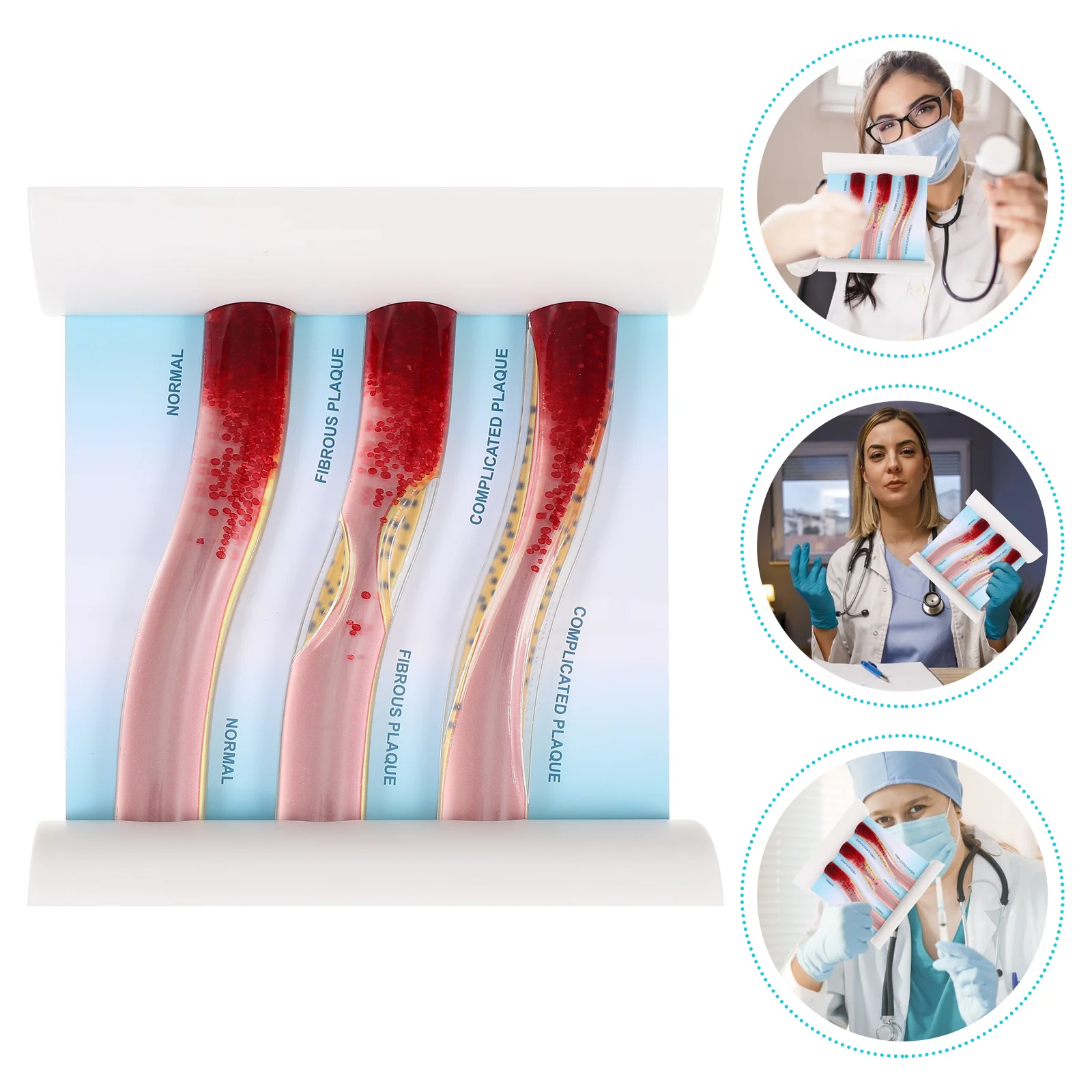 Plastic Model Vascular Blood Vessel Artery and Vein 15X14CM Pp The Hips Dynamic Anatomical