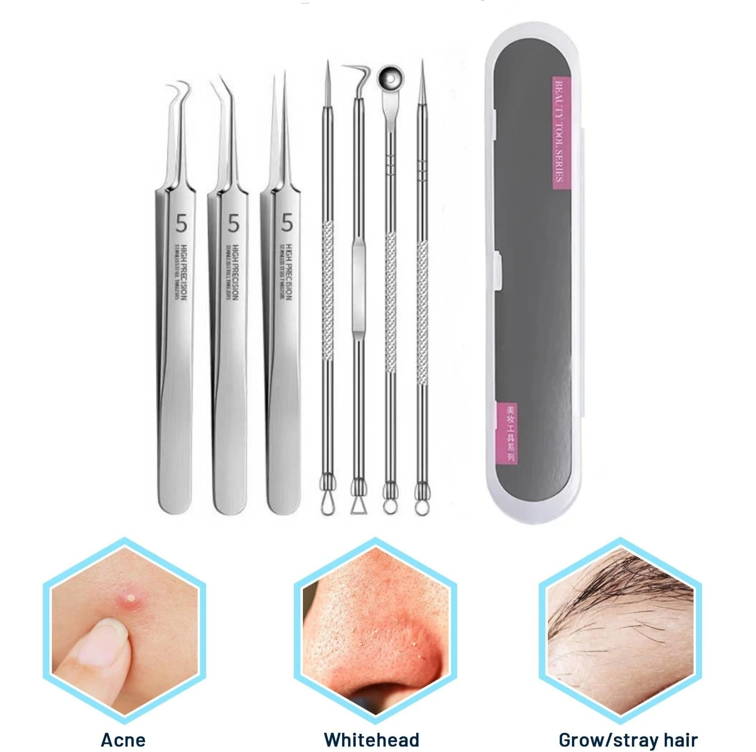 Set di strumenti per la rimozione di punti neri in acciaio inossidabile da 1/7 pezzi, clip per punti neri, pinzette, rimozione di punti neri per il viso di bellezza, strumento per ago per l'acne