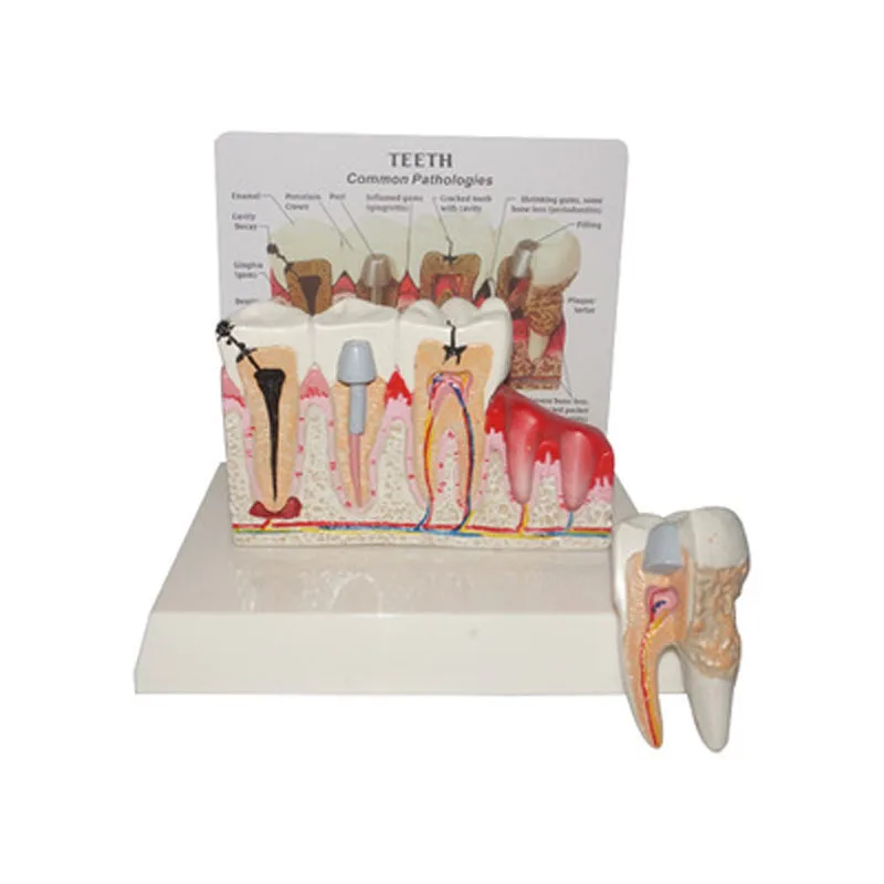 Standard Dental Oral Teeth Anatomical Teaching Model Comprehensive Tooth Structure Model Dentist Dental Student Demonstration