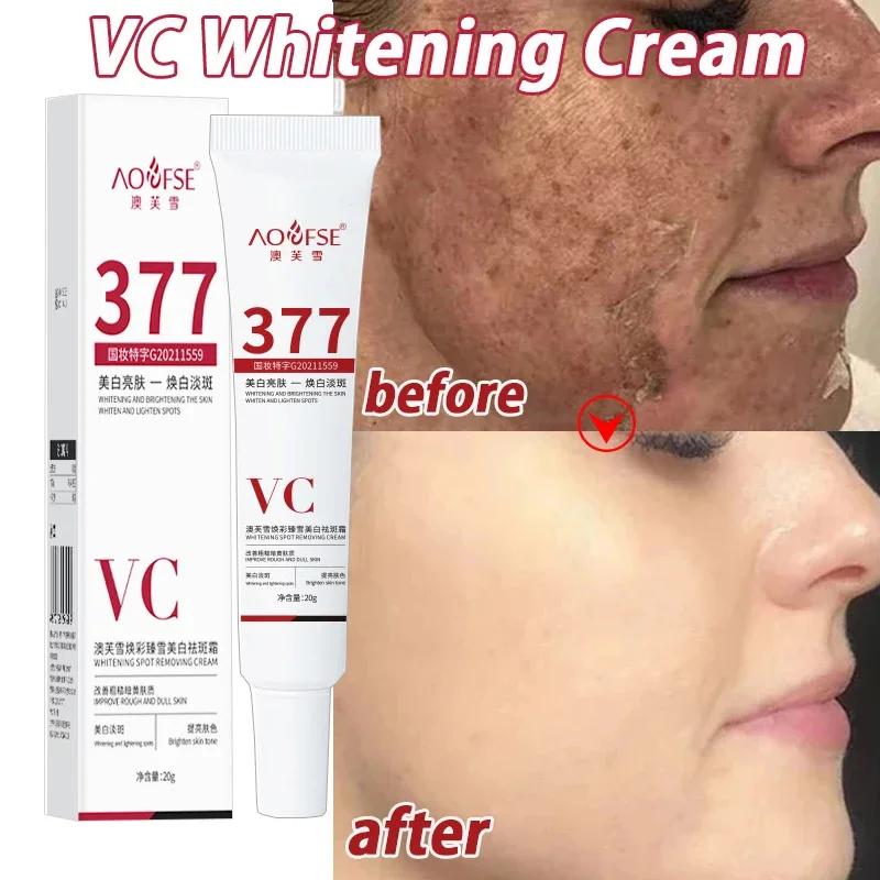 

Face Brightening Cream Niacinamide Reduce Chloasma Melasma Lighten Dark Skin Serum Fade Fine Lines Care Brighten Cream New