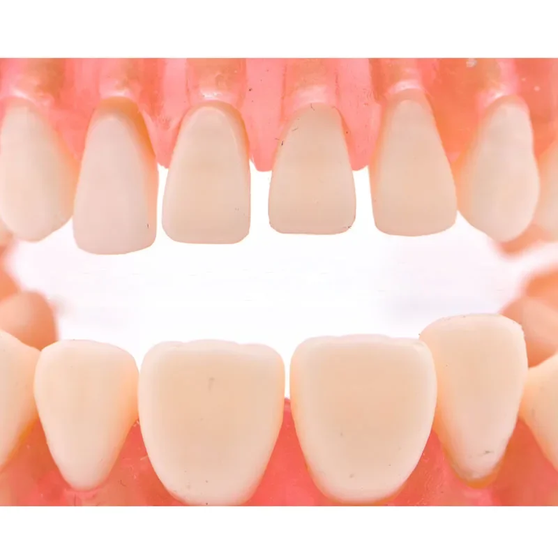 1:1 Life Size Dental Model Teeth Model Dental Teaching Model Standard Model Teeths Demonstration Soft Hard Gum Dental Instrument