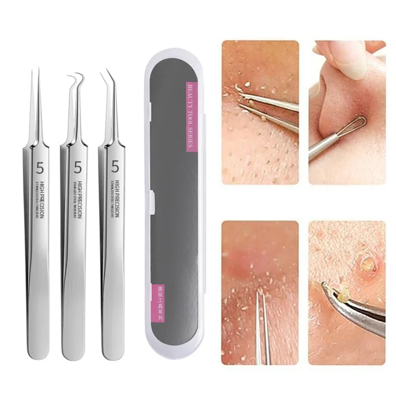 1PCS/3PCS Ultra Fine No 5 Cell Pimples Black Head Clip Tweezers Beauty Salon Special Scraping Closing Artifact Acne Needle Tools