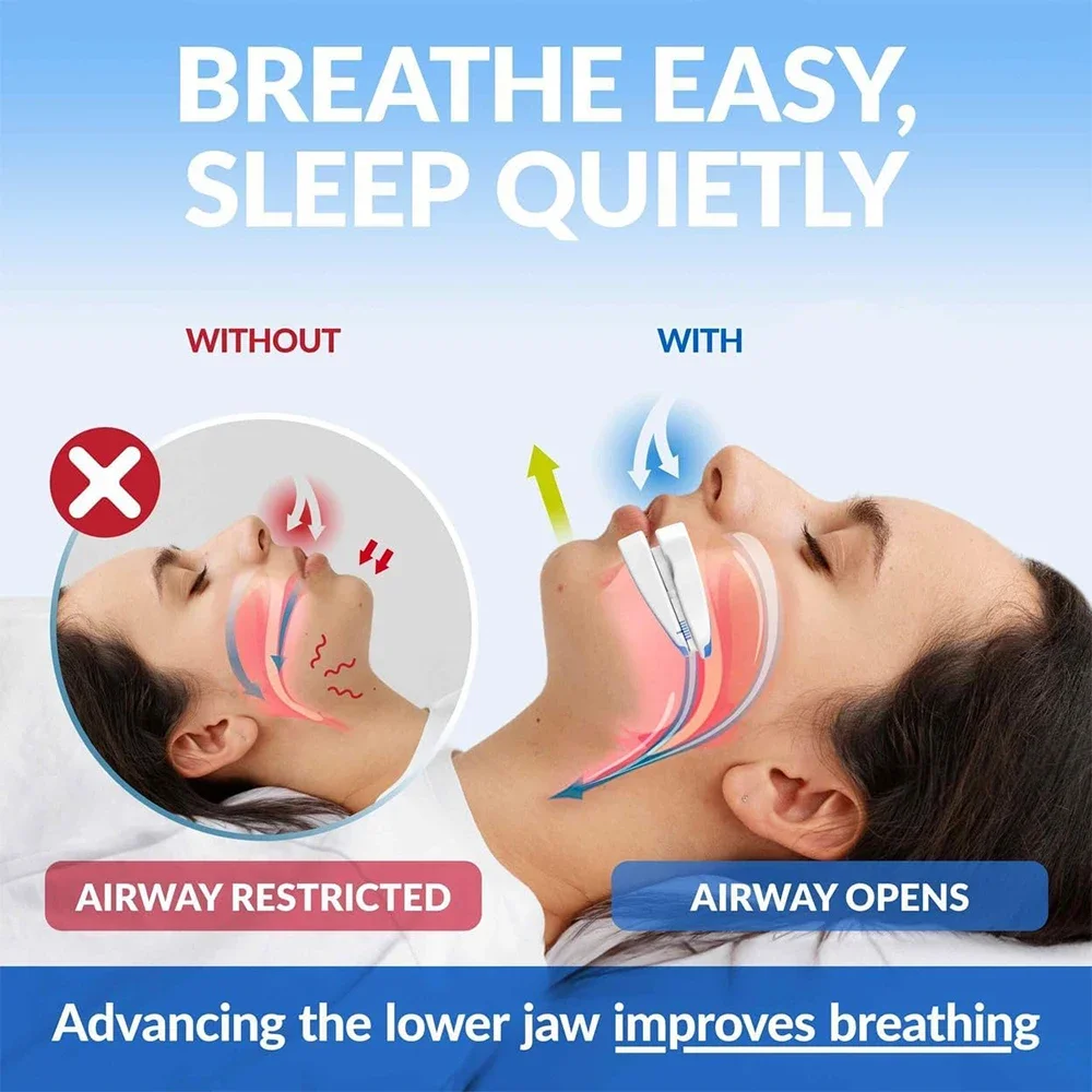 Adjustable Anti-Snoring Mouthpiece Device