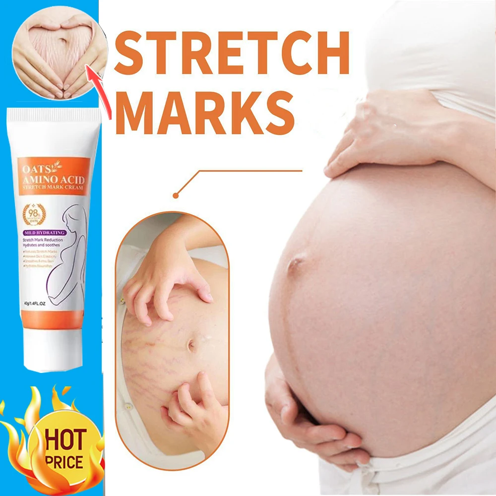 Remove Skin Cracks Repair Firming Care Stretch Marks Moisturize Cream Eliminate Body Belly Stretch Marks Removal Swelling Marks