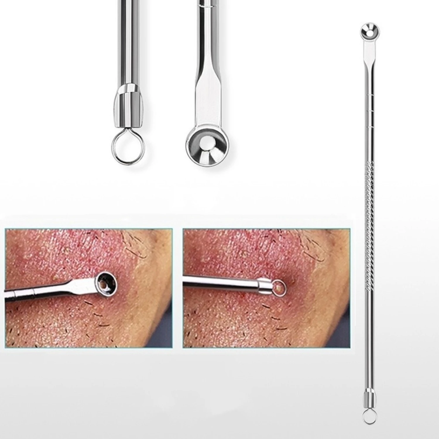 ニキビ針メイクアップ美容とニキビリムーバーニキビ針メイクアップリムーバーニードル