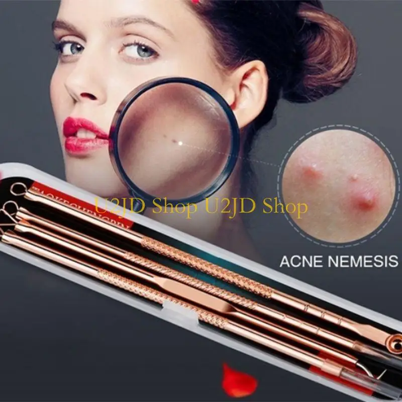 U2JD 4pcs/conjunto ouro aço inoxidável ACNE REMOVER ACULADOR ACNETENS ACULHAS PIMPLE COMEDONE DUBL