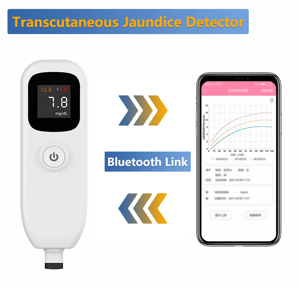 Transcutaneous Jaundice Detector for Neonatal Jaundice Meter Transcutaneous Bilirubinometer Bilirubin Meter for Hospital Clinic