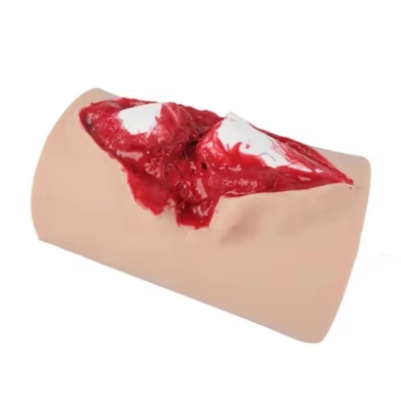 Open Tibial Fracture Training Module Wearable Open Fracture Wound Simulation Suture Training Model