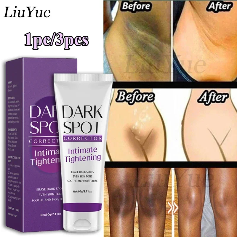 

Quickly Private Parts Whitening Cream Dark Skin Underarm Brightening Cream Inner Thighs Elbows Bleach Joint Remove Melanin Cream