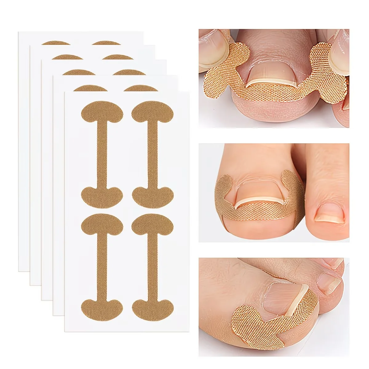 40 stuks teennagelcorrectiepleisters zelfklevend ingegroeide teennagel correctie strip nagelcover sticker nagelcorrector pedicure tool - afbeelding 2