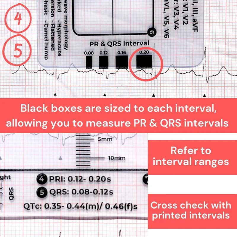 ECG 7 Step Ruler, ECG 7 Step Ruler For ECG/EKG Interpretation, Rapid And Quick Cardiac Analysis And Measurement Tool