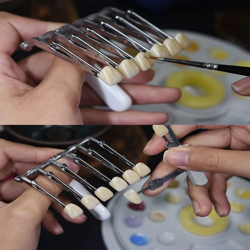 11Pcs Dental Temporary Veneer Porcelain False Teeth Clip Brush Glazing Six Tooth Clamp Single Crown Veneer Denture Material Tool