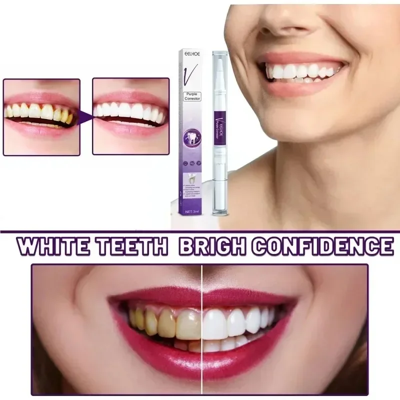 Dentes profissionais branqueamento creme dental Kit, cor roxa, branqueamento dental, remover manchas amarelas, respiração fresca, sorrir Mousse, V34