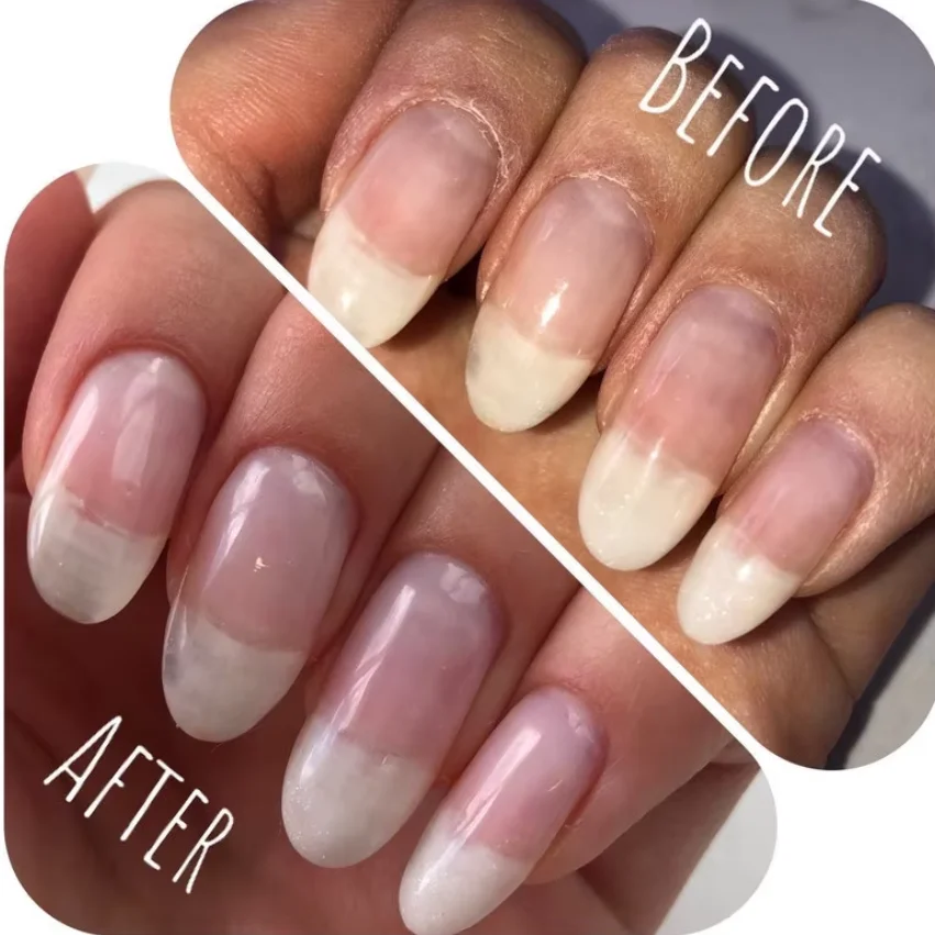 

Nail growth promoter silicon garlic calcium collagen jojoba brittle nail growth essence nail strengthener nail repair liquid