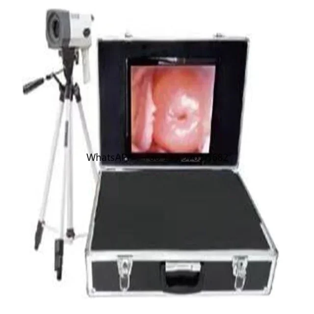 

Medical Hospital Clinic High Quality CCD CONTROL Most Cheapest 1.3 million Pixel Handheld Electronic Colposcopy co-lposcope