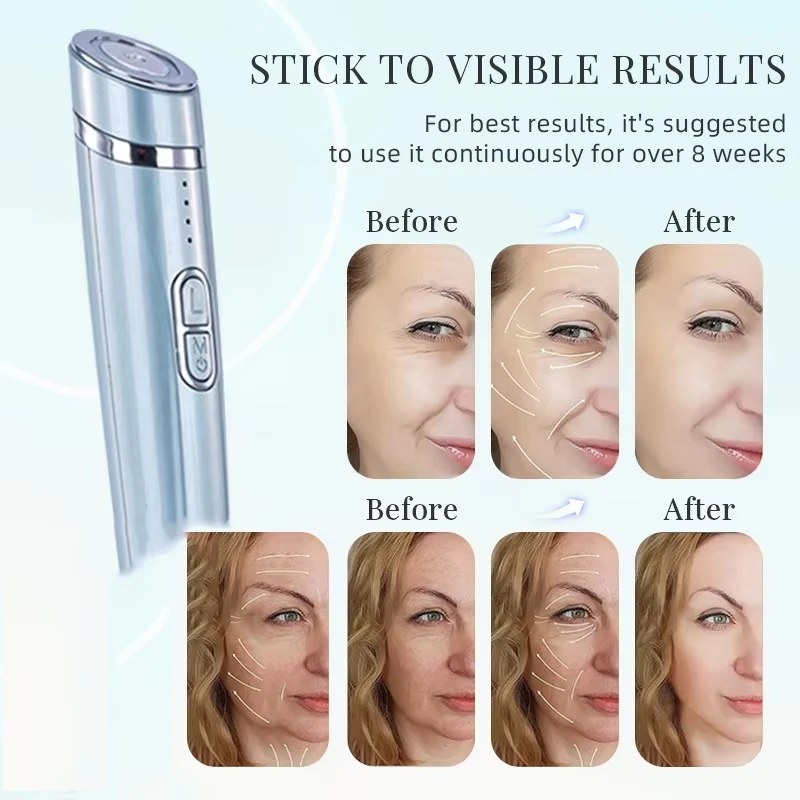 눈 마사지기 눈 미용 기기 다크서클 부기 주름 제거 안티에이징 잔주름 리프팅 탄력 강화 피부 관리 도구