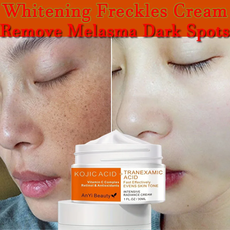 

Vitamin C Whitening Freckles Cream Remove Melasma Dark Spots Lighten Melanin Acne Scar Anti-aging Brighten Korean Skin Care