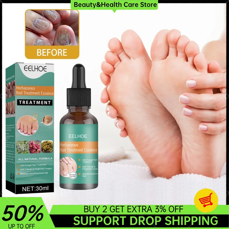 Onychomycosis Repair Solution Hand and Foot Soft Nail Thickening Brightening Nail Anti-Fungal Polish Bump Nail Care Solution