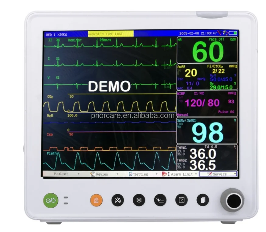 12.1 inch CA600 6 parameters portable veterinary Vital Sign for icu and hospital with capnograph