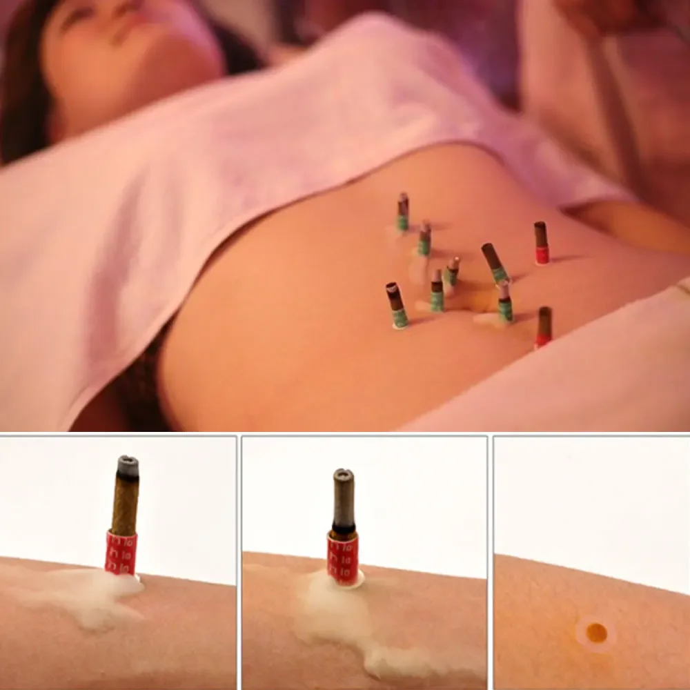 

180pcs Mini Moxa Self Stick-On Chinese Moxibustion Therapy Mini Massage Heating Acupuncture Moxa Tube