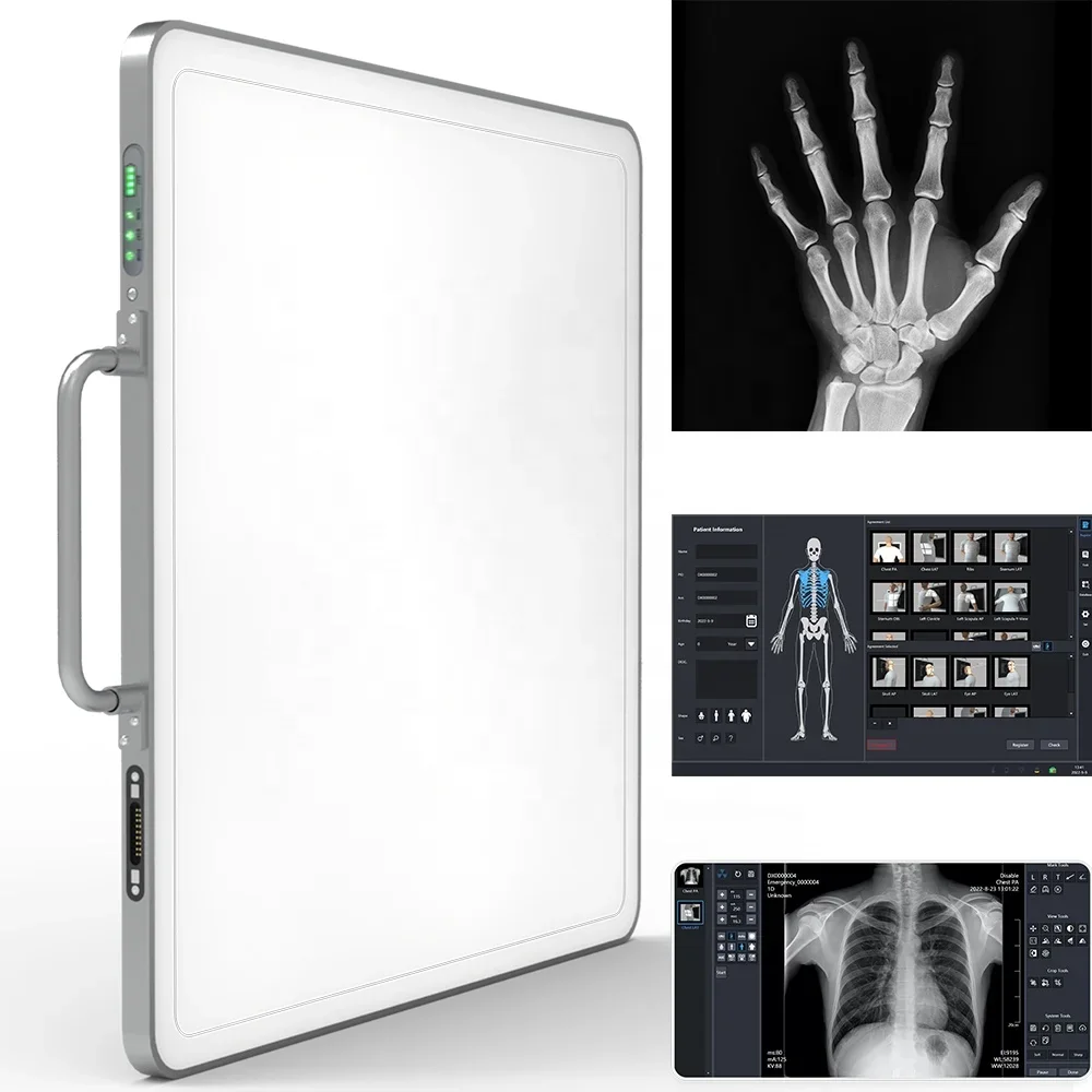 Medical X Ray Flat Panel Detector Veterinary Digital Flat Panel X-ray DR System Cmos Wireless Xray Flat Panel Detector