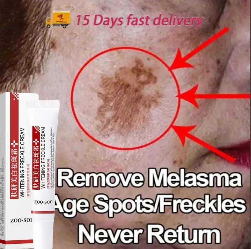 Powerful Spot-removing Whiten Cream Brighten Skin Fast Eliminates Pigmentation Melasma Dark Spots Moisturize Beauty Gel