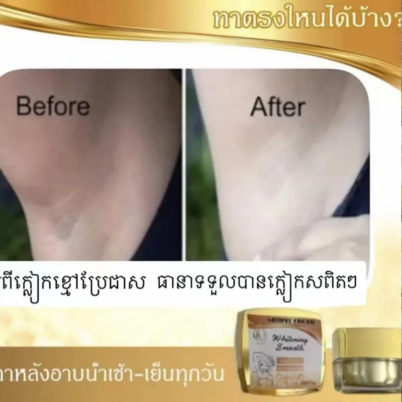 

Thái Lan chống mồ hôi nách khử mùi làm trắng da mịn màng 15g bottle