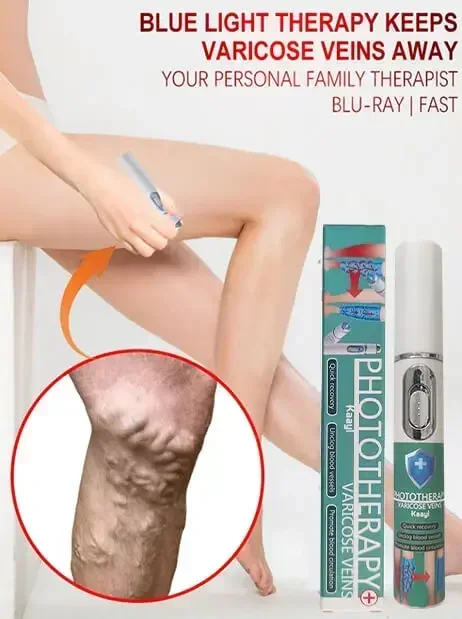 Vena laser |   esercizi sulle vene |   trainer delle vene |   esercizi per le mani delle vene